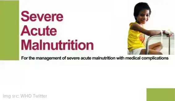 severe-acute-malnutrition--with-complications