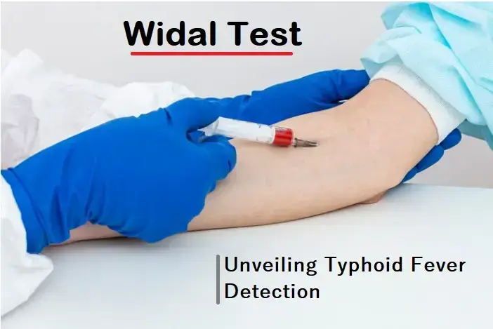 navigating-the-widal-test:-unveiling-typhoid-fever-detection